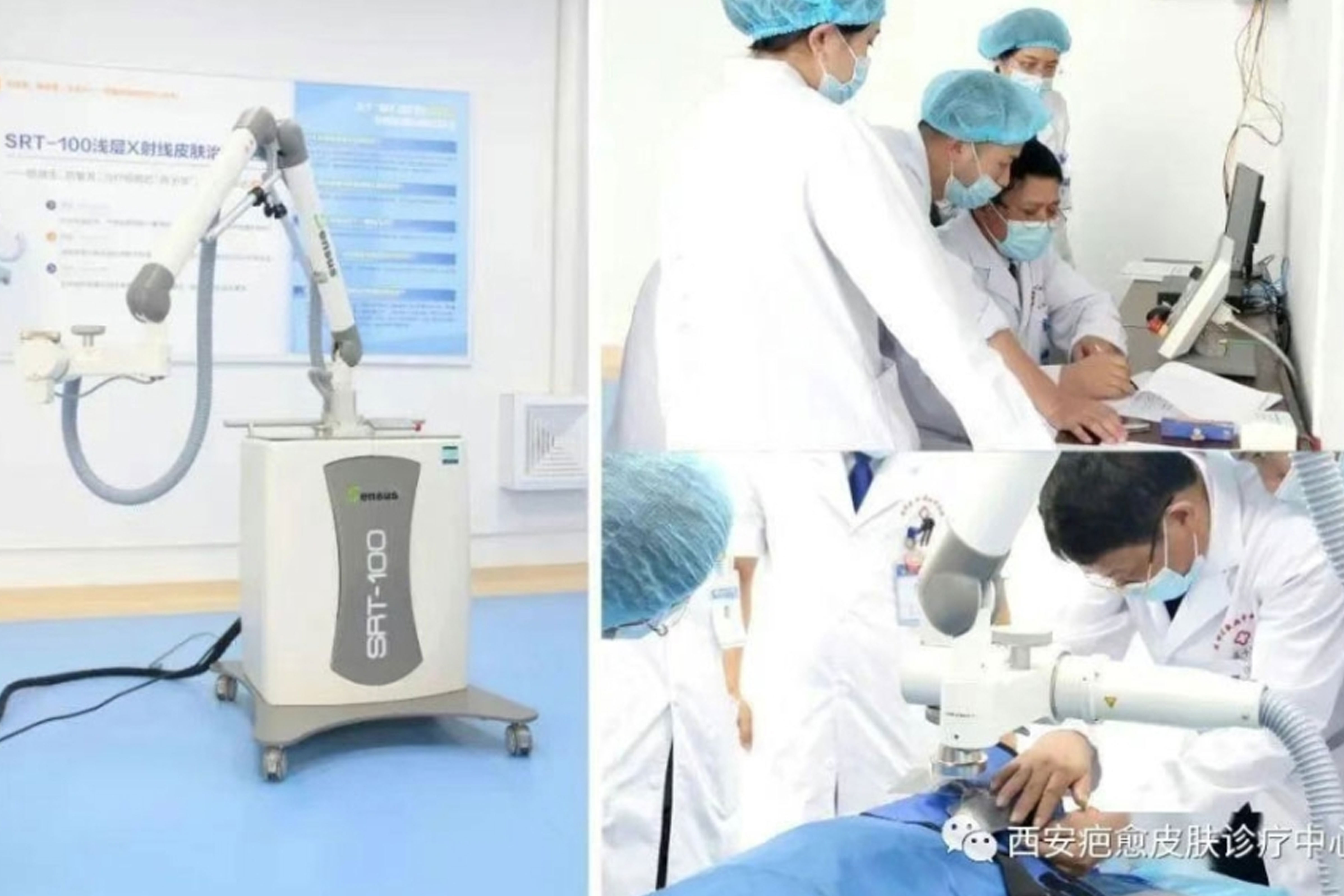 摊牌了，来吐槽一下浅层放疗的缺点