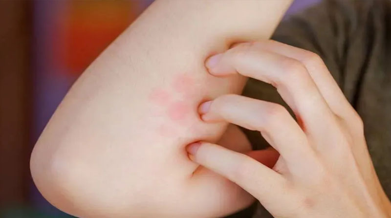 瘢痕康复 | 疤痕增生奇痒难忍、疼痛甚至灼热怎